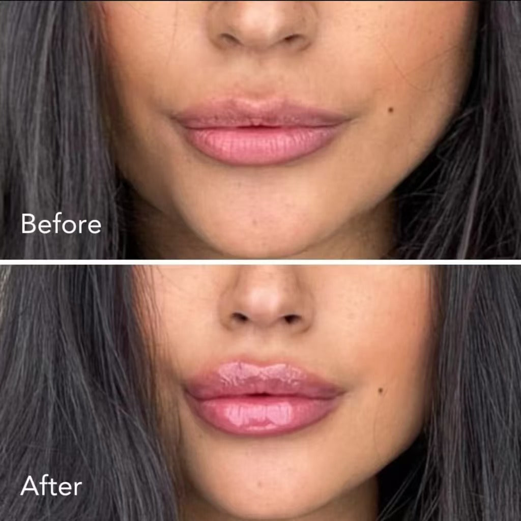 Gloss Rellenador de Labios con Aceite Hidratante